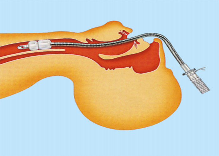 Medical Stainless Steel Laser Resistant Endotracheal Tube for Laser